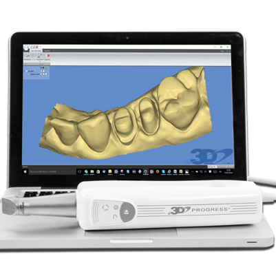 Интраоральный сканер (Италия)